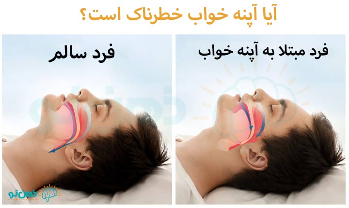 آیا آپنه خواب خطرناک است