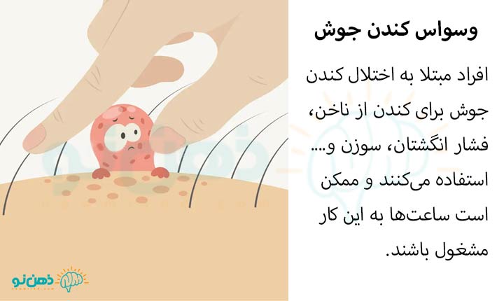 تعریف وسواس کندن جوش