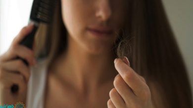 ریزش مو عصبی