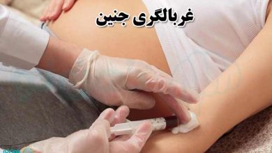 غربالگری جنین