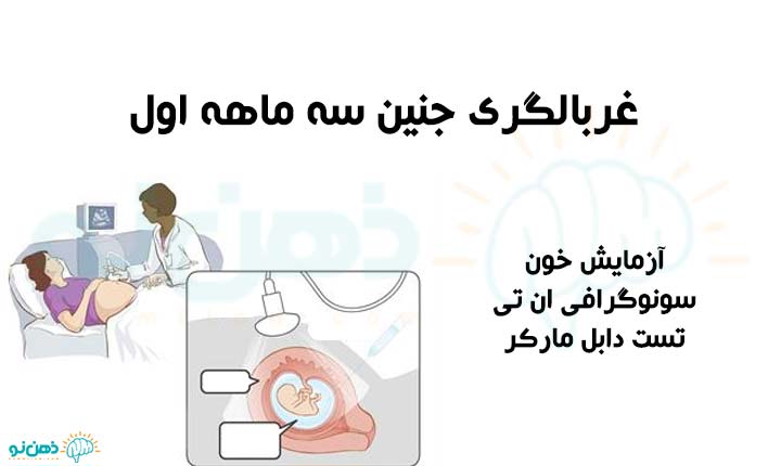غربالگری جنین سه ماهه اول