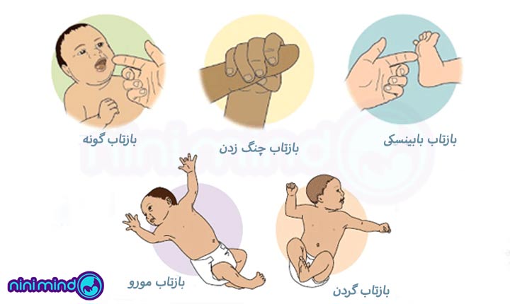 بازتاب نوزادان | انواع بازتاب های نوزاد