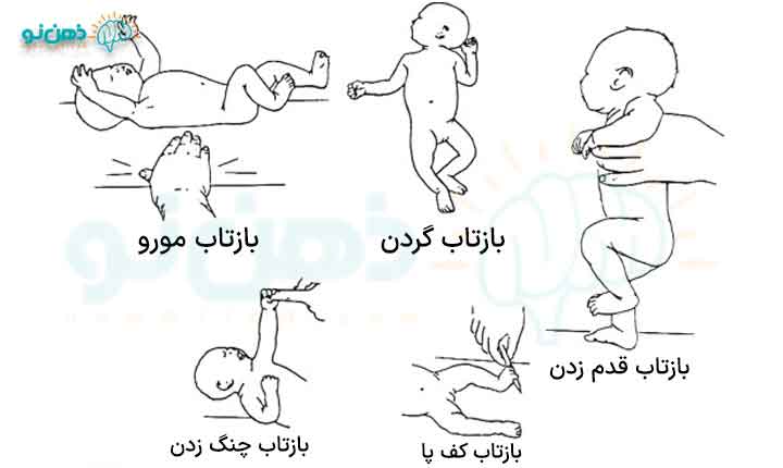 رفلکس تونیک گردن