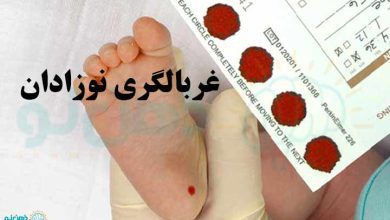 غربالگری نوزادان
