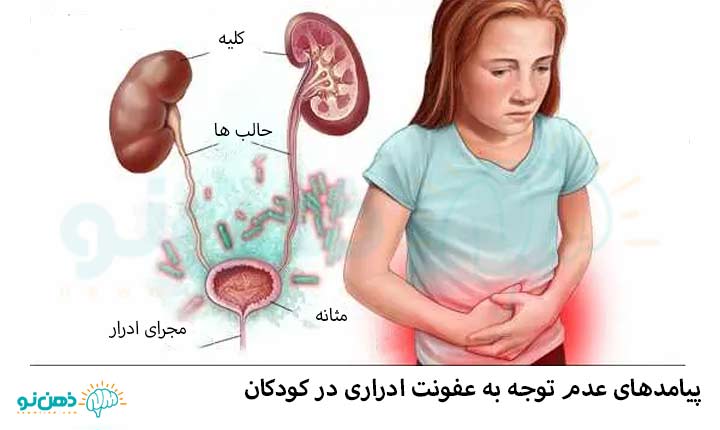 عفونت ادراری کودکان