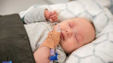 بیماری تای ساکس