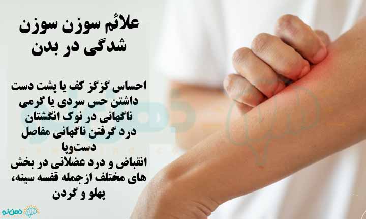 علائم سوزن سوزن شدن بدن