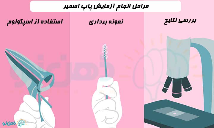 مراحل انجام آزمایش پاپ اسمیر