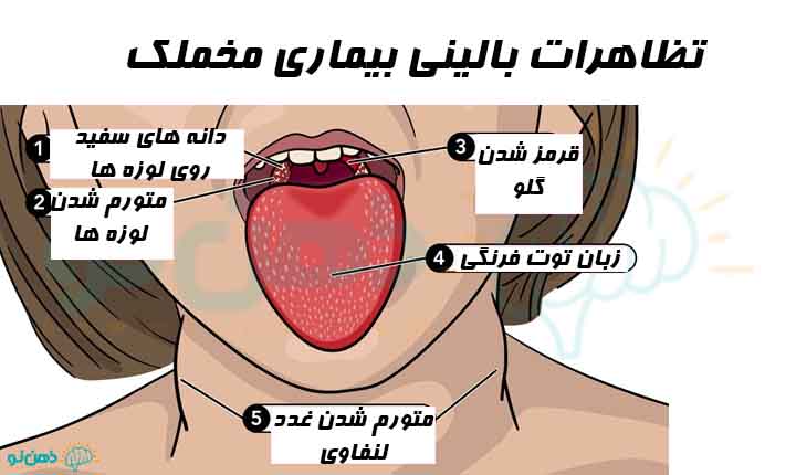 نشانه های بیماری مخملک