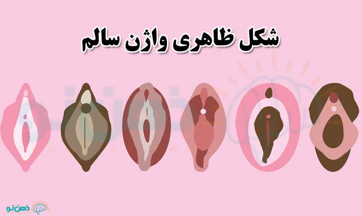 واژن سالم