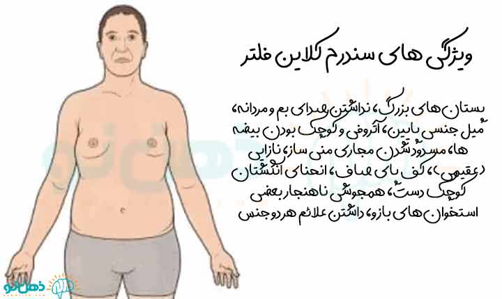 ویژگی های سندرم کلاین فلتر