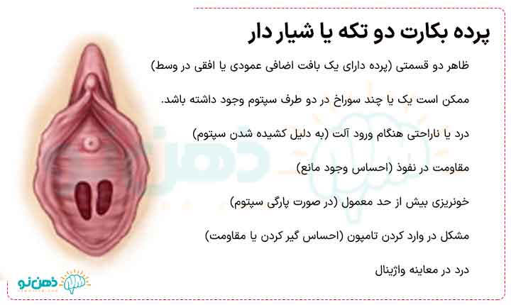 پرده دو تکه شیار دار تیغه ای