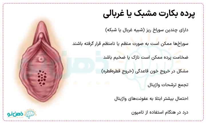 پرده مشبک و غربالی