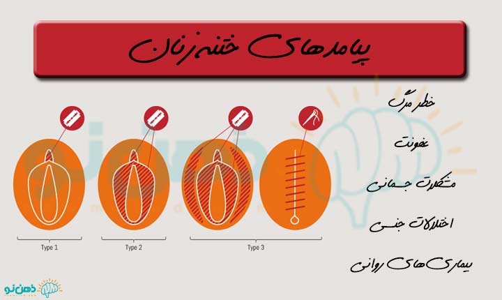 پیامدهای ختنه زنان
