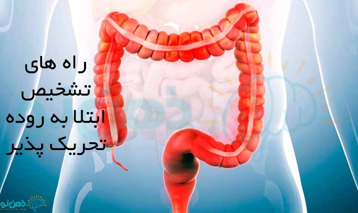 تشخیص ابتلا به روده تحریک پذیر