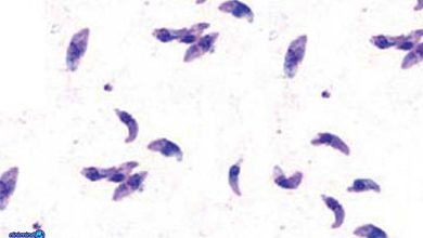 توکسوپلاسموز