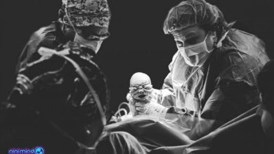 مرگ در زایمان سزارین