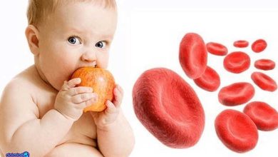 کم خونی داسی شکل کودکان