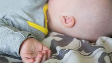 ماکروسفالی