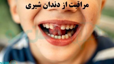 مراقبت از دندان شیری