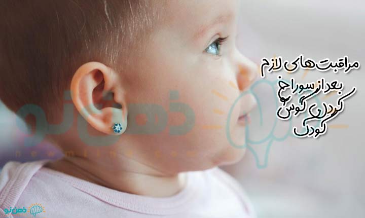مراقبت‌های لازم بعد از سوراخ کردن گوش کودک