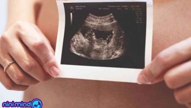 تعیین جنسیت جنین