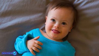 سندروم داون (down syndrome) | علائم ، انواع و طول عمر بیماران داون