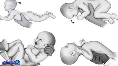 بازتاب لابیرنتی در نوزادان از چه زمانی ظاهر میشود؟