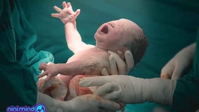 انواع زایمان