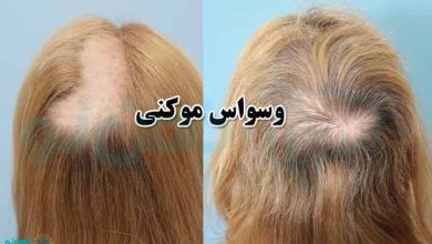 وسواس موکنی