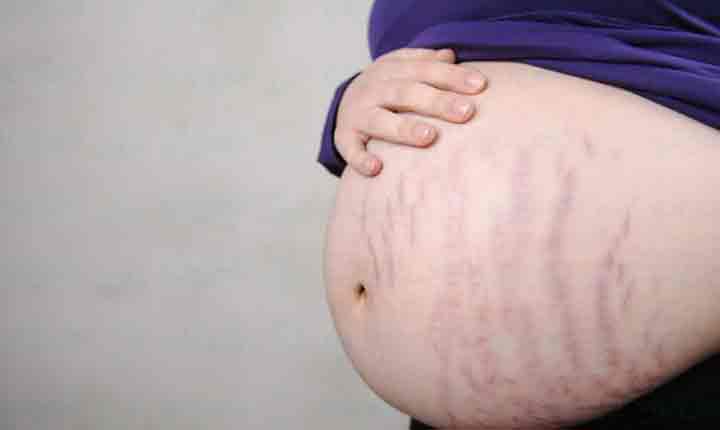 زمان شروع تغییرات پوستی در بارداری