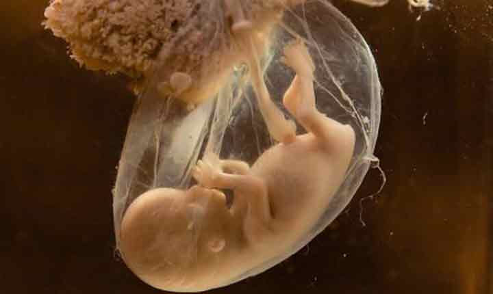 بیماری هایی در مادران که مایع آمونیتیک کمی در جنین آنها وجود دارد