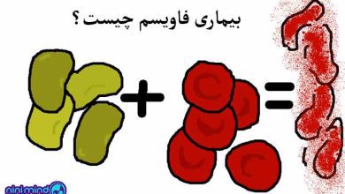 بیماری فاویسم