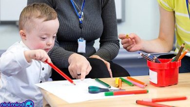 درمان سندروم داون