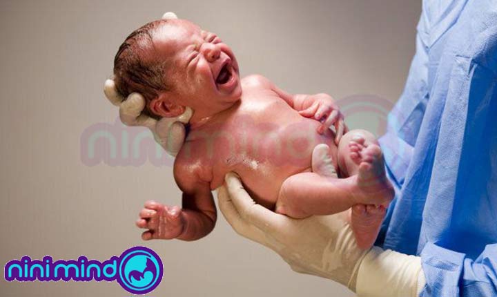 مقیاس-نمره-آپگار