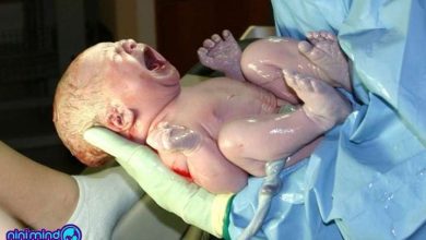 نمره آپگار نوزاد