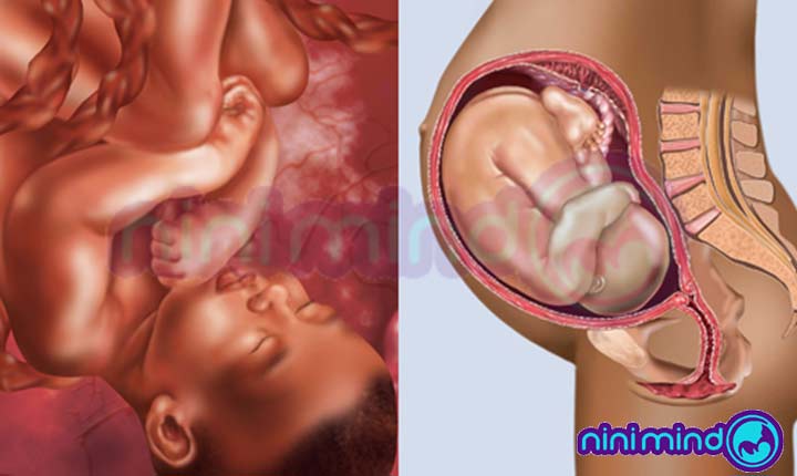 وضعیت-جنین-در-هفته-سی-و-نهم-بارداری