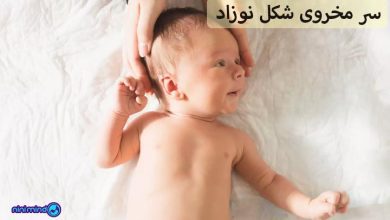 سر مخروطی شکل نوزاد