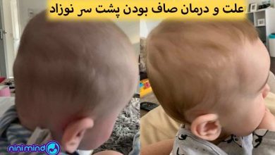 صاف بودن پشت سر نوزاد