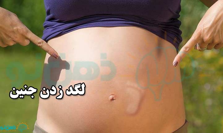 لگد زدن جنین