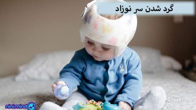 گرد شدن سر نوزاد
