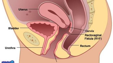 بارداری از طریق مقعد