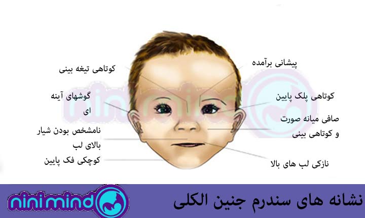 نشانه-های-جنین-الکلی