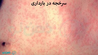 سرخجه در بارداری