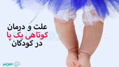 کوتاهی یک پا در کودکان