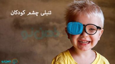 تنبلی چشم کودکان