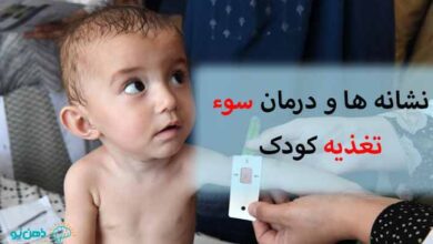 سوء تغذیه کودکان