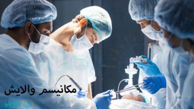 مکانیسم والایش