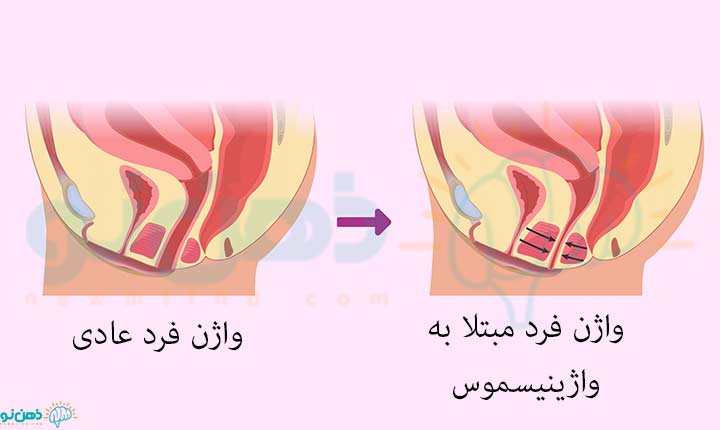 دلایل ابتلا به ترس از دخول