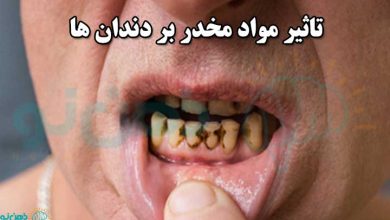 تاثیر مواد مخدر بر دندان ها